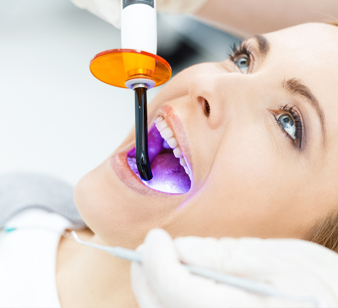 Teeth Whitening Irmadent Private dental & aesthetic clinic