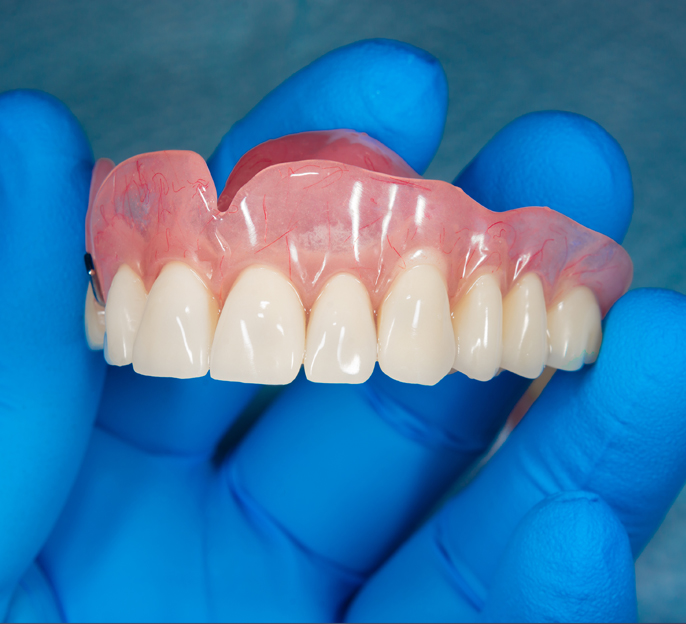 Acrylic-dentures