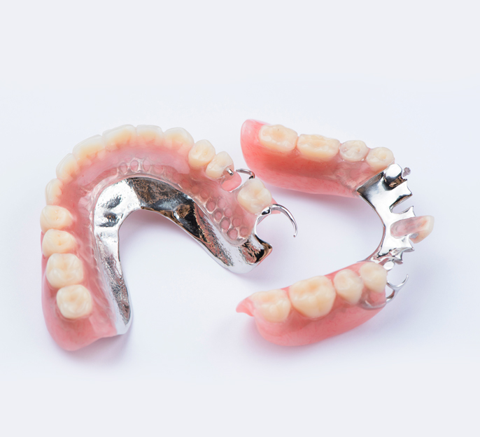 Metal-dentures