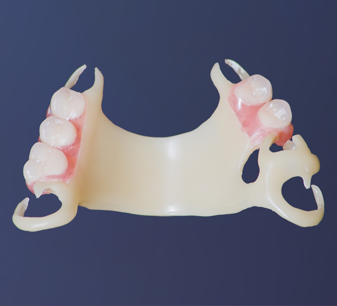 acetal-dentures
